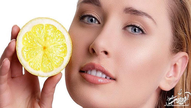 آب لیمو برای جوش صورت